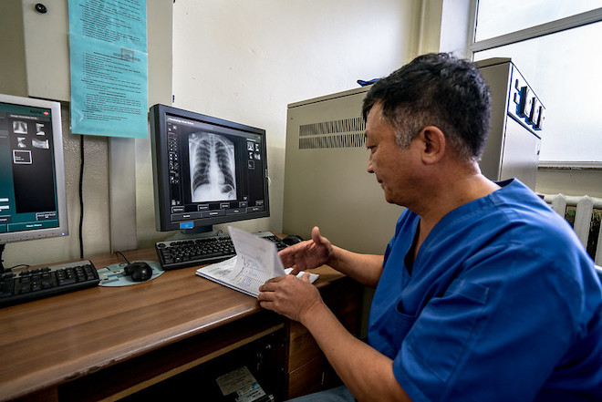 A medical worker looking at an X-ray scans on a computer screen.